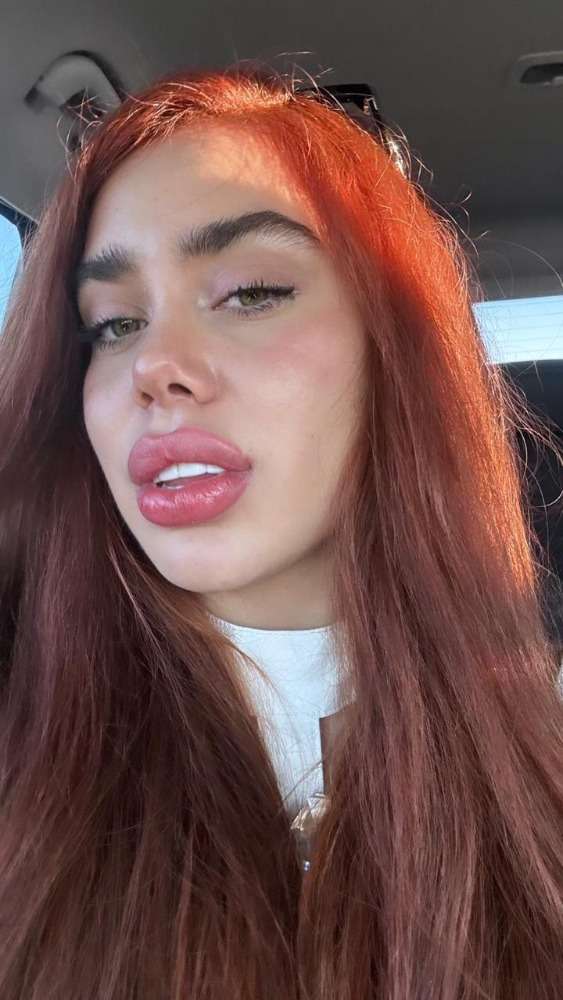 Sharon